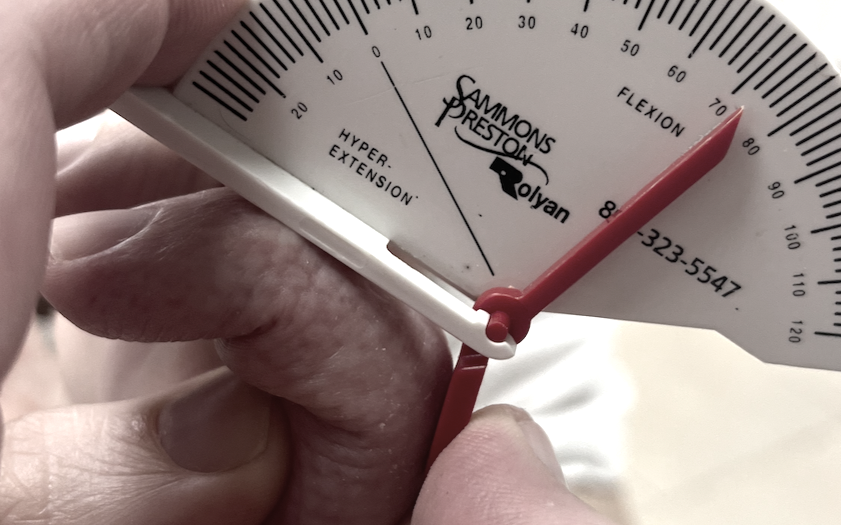 Razonamiento clínico en el diagnóstico y tratamiento de las lesiones de la mano.